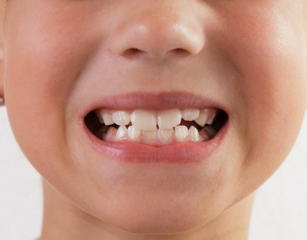 От чего портятся детские зубы: что должна знать мама